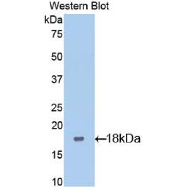 Leukemia Inhibitory Factor Receptor (LIFR) Mouse Polyclonal Antibody