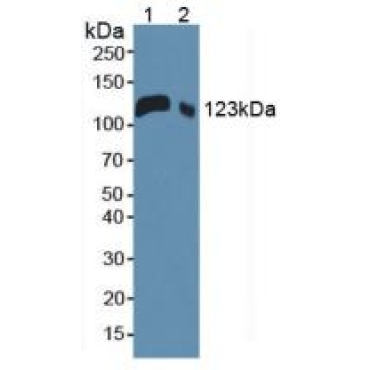 Leukemia Inhibitory Factor Receptor (LIFR) Mouse Polyclonal Antibody