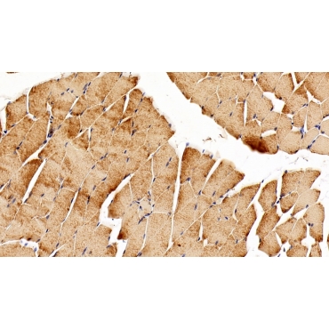 Leukemia Inhibitory Factor Receptor (LIFR) Mouse Polyclonal Antibody