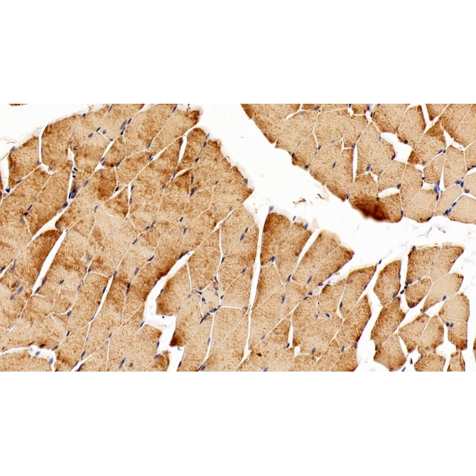 Leukemia Inhibitory Factor Receptor (LIFR) Mouse Polyclonal Antibody