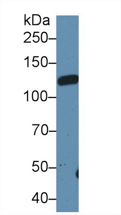 Leukemia Inhibitory Factor Receptor (LIFR) Rat Polyclonal Antibody