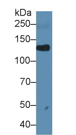 Leukemia Inhibitory Factor Receptor (LIFR) Rat Polyclonal Antibody