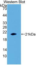 Interleukin 1 Beta (IL1b) Human Polyclonal Antibody