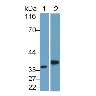 Interleukin 1 Beta (IL1b) Mouse Polyclonal Antibody