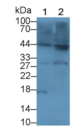 Interleukin 1 Beta (IL1b) Rabbit Polyclonal Antibody