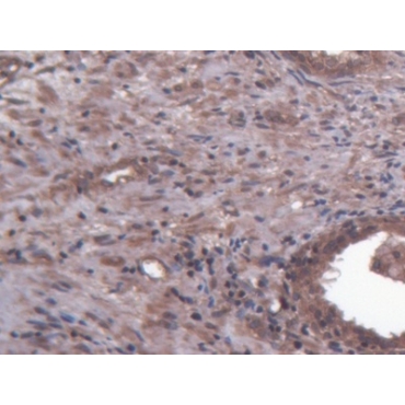 Heparan Sulfate Proteoglycan (HSPG) Human Polyclonal Antibody