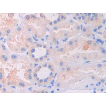 Interleukin 1 Delta (FIL1d) Human Polyclonal Antibody