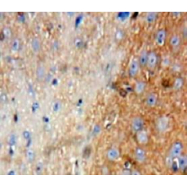 Interleukin 1 Delta (FIL1d) Human Polyclonal Antibody