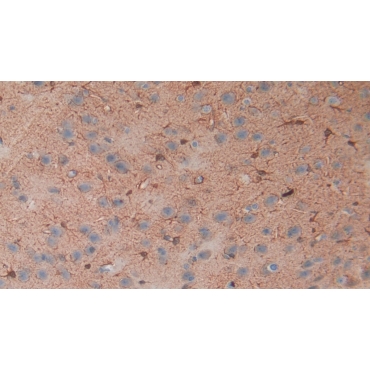 S100 Calcium Binding Protein B (S100B) Human Polyclonal Antibody