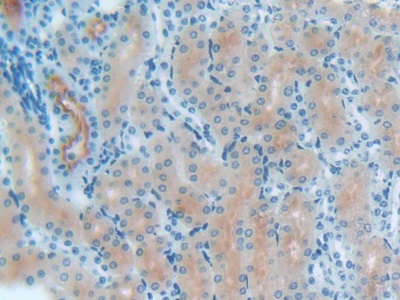 S100 Calcium Binding Protein B (S100B) Mouse Polyclonal Antibody