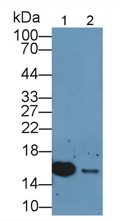 S100 Calcium Binding Protein A11 (S100A11) Rabbit Polyclonal Antibody