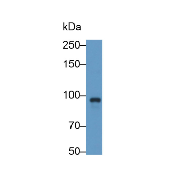 P-Selectin (SELP) Human Polyclonal Antibody