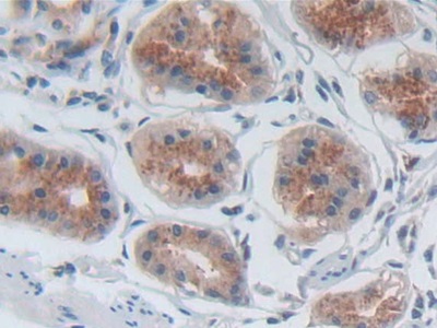 P-Selectin (SELP) Human Polyclonal Antibody