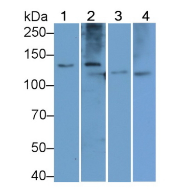 Procollagen I C-Terminal Propeptide (PICP) Human Polyclonal Antibody