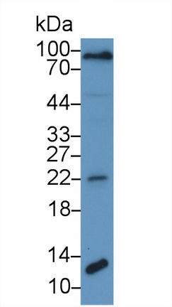 Procollagen III N-Terminal Propeptide (PIIINP) Pan-species (General) Polyclonal Antibody