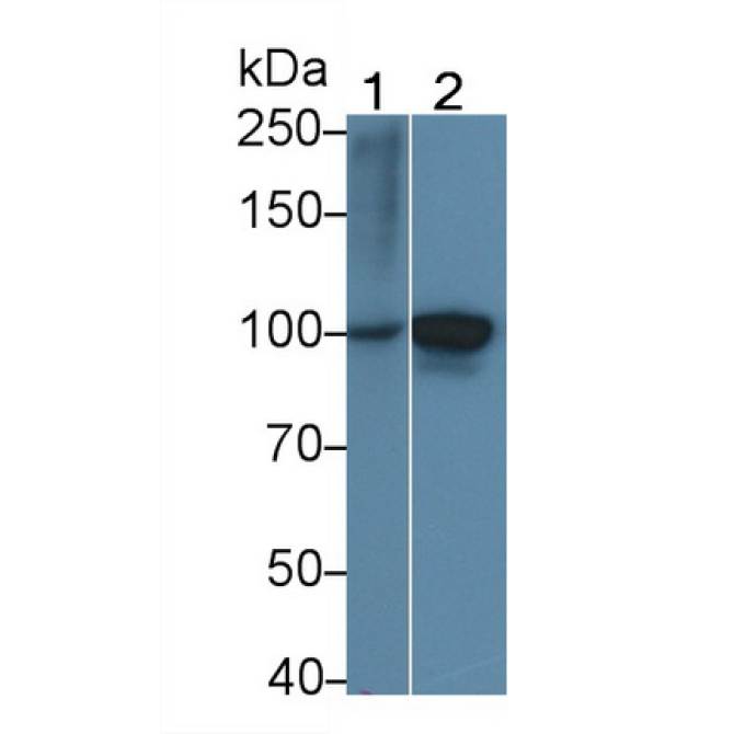 Procollagen III N-Terminal Propeptide (PIIINP) Human Polyclonal Antibody