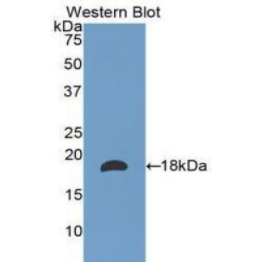 Laminin Alpha 1 (LAMA1) Human Polyclonal Antibody