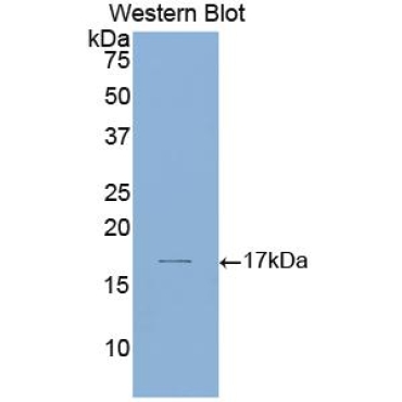 Laminin Alpha 1 (LAMA1) Human Polyclonal Antibody