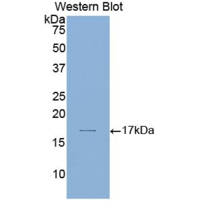 Laminin Alpha 1 (LAMA1) Human Polyclonal Antibody