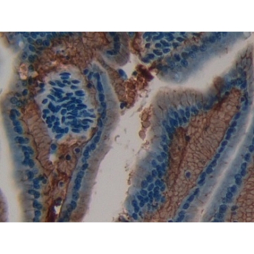 Laminin Alpha 1 (LAMA1) Mouse Polyclonal Antibody