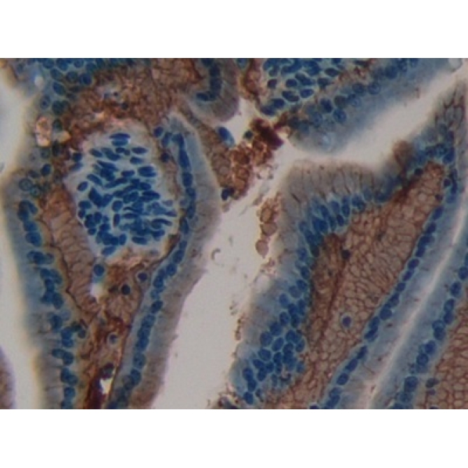 Laminin Alpha 1 (LAMA1) Mouse Polyclonal Antibody