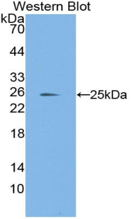 Laminin Alpha 1 (LAMA1) Rat Polyclonal Antibody