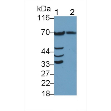 Phospholipase A2 Activating Protein (PLAP) Human Polyclonal Antibody