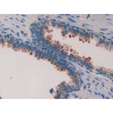 Phospholipase A2 Activating Protein (PLAP) Human Polyclonal Antibody
