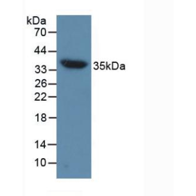 Aquaporin 4 (AQP4) Mouse Polyclonal Antibody