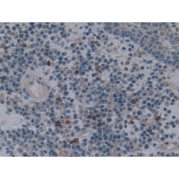 Heme Oxygenase 1 (HO1) Human Polyclonal Antibody