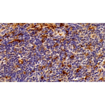 Heme Oxygenase 1 (HO1) Human Polyclonal Antibody