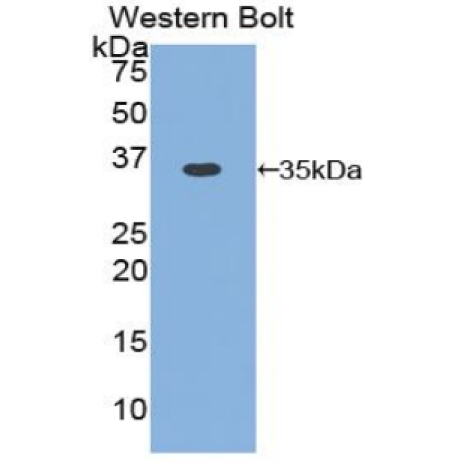 Cyclin D1 (CCND1) Chicken (Gallus) Polyclonal Antibody