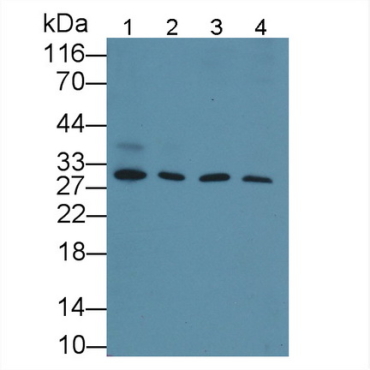 Cyclin D1 (CCND1) Human Polyclonal Antibody