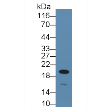 Cyclin D3 (CCND3) Human Polyclonal Antibody