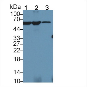 Pyruvate kinase isozymes M2 (PKM2) Hamster (Chinese hamster) Polyclonal Antibody