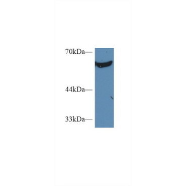 Pyruvate kinase isozymes M2 (PKM2) Human Polyclonal Antibody