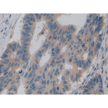 Pyruvate kinase isozymes M2 (PKM2) Human Polyclonal Antibody