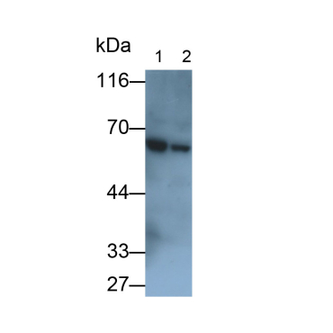 Pyruvate kinase isozymes M2 (PKM2) Human Polyclonal Antibody