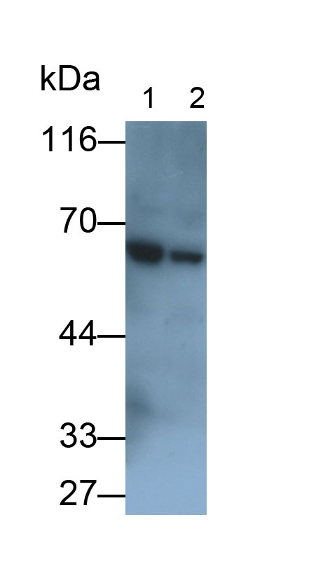 Pyruvate kinase isozymes M2 (PKM2) Human Polyclonal Antibody