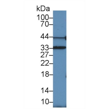 Proliferating Cell Nuclear Antigen (PCNA) Human Polyclonal Antibody