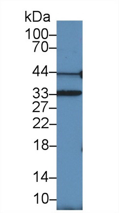 Proliferating Cell Nuclear Antigen (PCNA) Human Polyclonal Antibody
