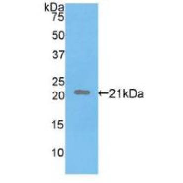 Fibrillin 1 (FBN1) Human Polyclonal Antibody