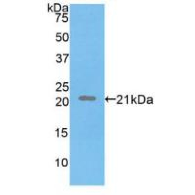 Fibrillin 1 (FBN1) Human Polyclonal Antibody