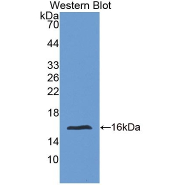 Fibrillin 1 (FBN1) Human Polyclonal Antibody