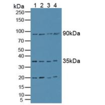 Superoxide Dismutase Copper Chaperone Human Polyclonal Antibody