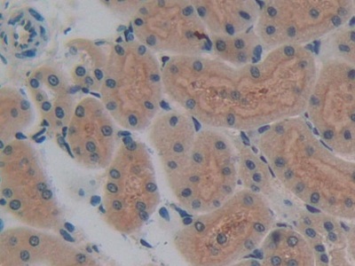 Superoxide Dismutase Copper Chaperone Rat Polyclonal Antibody