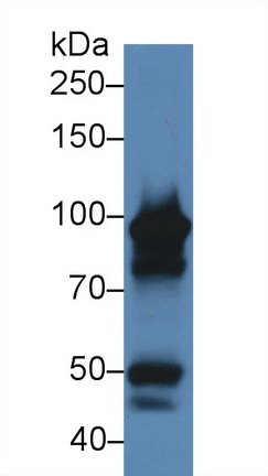 Myeloperoxidase (MPO) Human Polyclonal Antibody