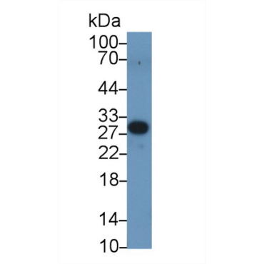 Peroxisomal Biogenesis Factor 2 (PEX2) Human Polyclonal Antibody