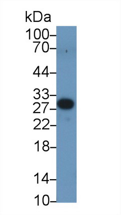 Peroxisomal Biogenesis Factor 2 (PEX2) Human Polyclonal Antibody