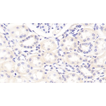 Apolipoprotein B100 (APOB100) Bovine (Cattle) Polyclonal Antibody